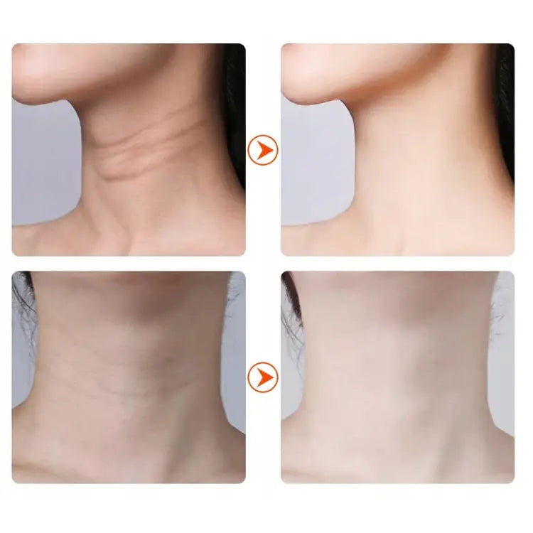 Massasjeapparat V20, før-og-etter-bilde som viser forbedret hudstruktur på kvinnes hals etter bruk.